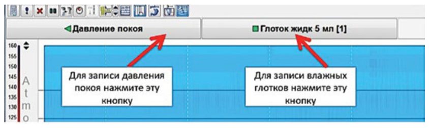 Инициация записи давления покоя и «влажного глотка»