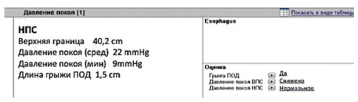 Заключение программы (Scoring) о снижении давления покоя НПС