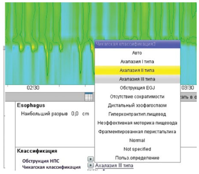 Работа в режиме Edit: изменение заключения по Чикагской классификации