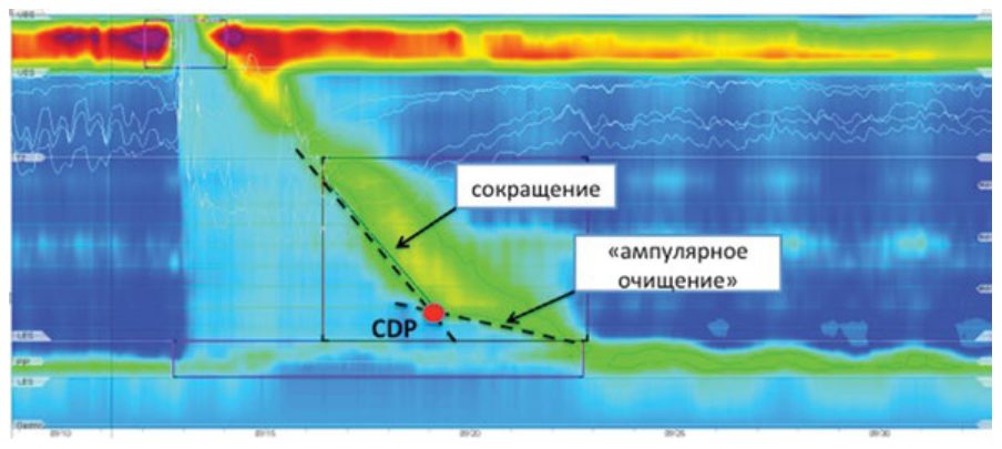 Точка замедления сокращения на изобаре 30 мм рт.ст.