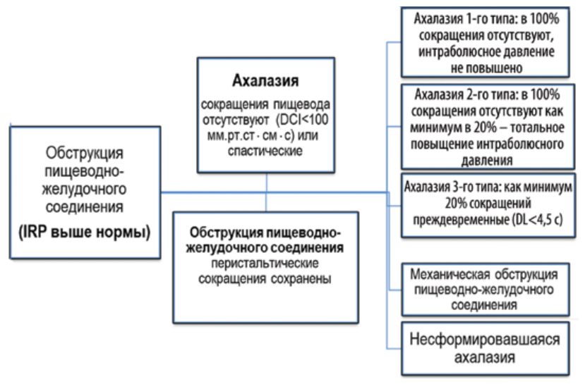 Чикагская классификация: нарушения, обусловленные обструкцией пищеводно-желудочного соединения